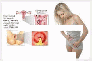 Cara Mengobati Hematuria Secara Alami Cara Mengobati Hematuria Secara Alami