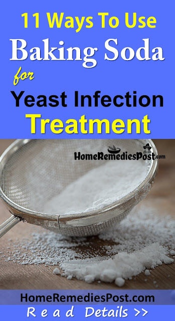 11 Natural Ways To Use Baking Soda For Yeast Infection Baking Soda For Yeast Infection, Baking Soda and Yeast Infection, How To Get Rid Of Yeast Infection, Home Remedies For Yeast Infection, Vaginal yeast Infection, How To Use Baking Soda For Yeast Infection, Is Baking Soda Good For Yeast Infection