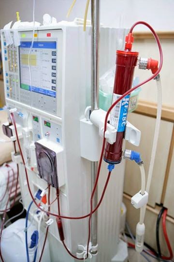 嬰幼兒專用迷你洗腎機挽救小生命