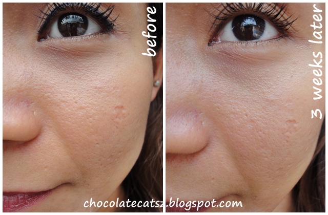 clinique pore refining solutions correcting serum