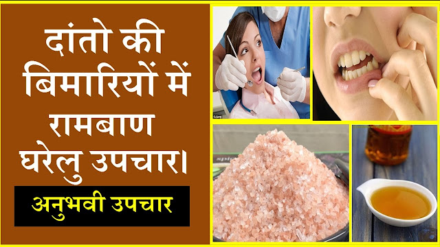 दाँतो में ठंडा गरम लगना, मसूढ़ों से खून आना, दर्द होना के अचूक इलाज दाँतो में ठंडा गरम लगना, मसूढ़ों से खून आना, दर्द होना के अचूक इलाज