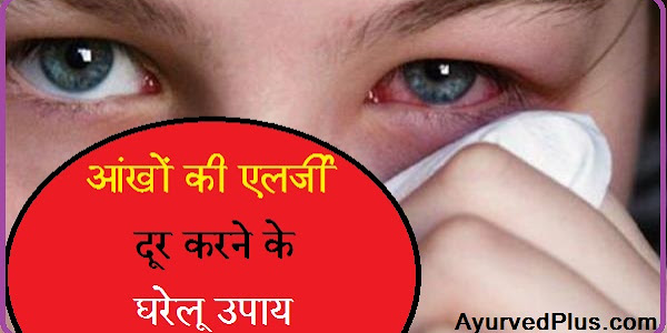 आंखों की एलर्जी दूर करने के घरेलू उपाय
