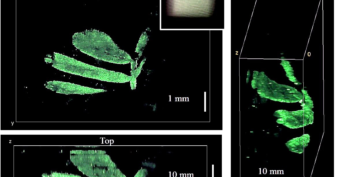 Without scan. Without scan. Инвазивный аспергиллез кт. Without scan. Контраст скан.