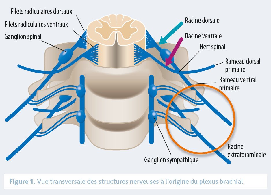 Electroneuromyographie Evaluation ENMG du Plexus Brachial