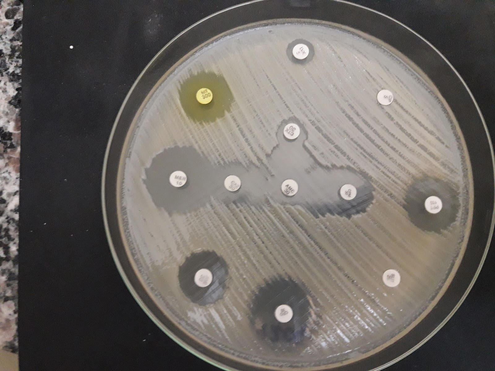 Klebsiella Pneumoniae Esbl
