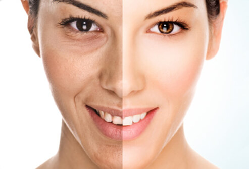 kesehatan-kulit-wajah-nona-hitam-pahit-dengan-renewskin kesehatan-kulit-wajah-nona-hitam-pahit-dengan-renewskin