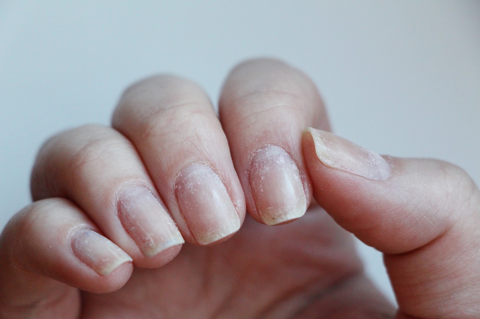 Ногти слоятся что делать в домашних условиях. Ногти после снятия гель лака. Тонкие ногти. Ногти после снятия шеллака.