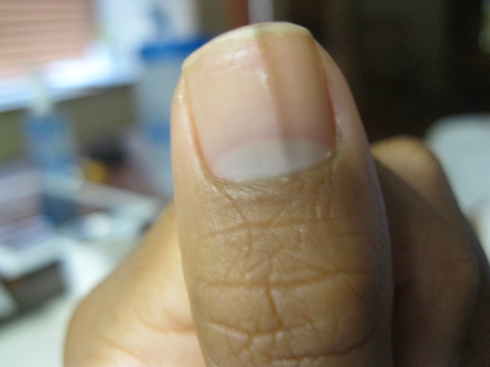 black line on nail pictures, photos