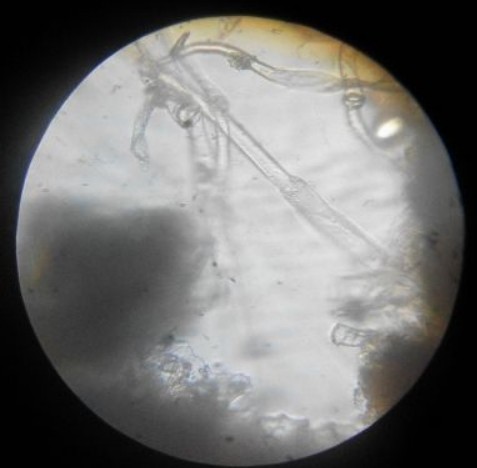 Jurnal typus keperawatan demam dosis efektif pasti diketahui pemberian FATMA ZAHRA (fzahra): TUGAS MANDIRI PRAKTIKUM FARMAKOGNOSI-FITO I