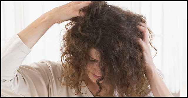 Dry Scalp: Signs And Home Remedies Dry Scalp: Signs And Home Remedies
