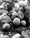 Blood Cells Blood cells, Immunotherapy treatment, www.bellybuttonpanda.co.uk
