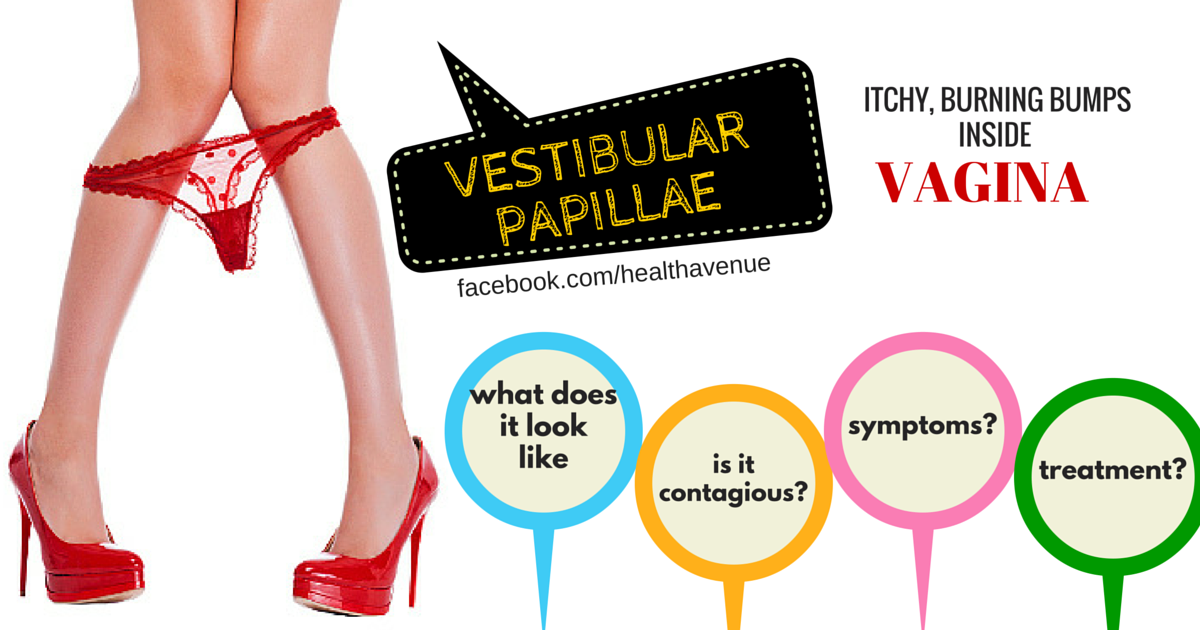 health fitness advice g vagina nicknames health fitness advice g vagina nicknames
