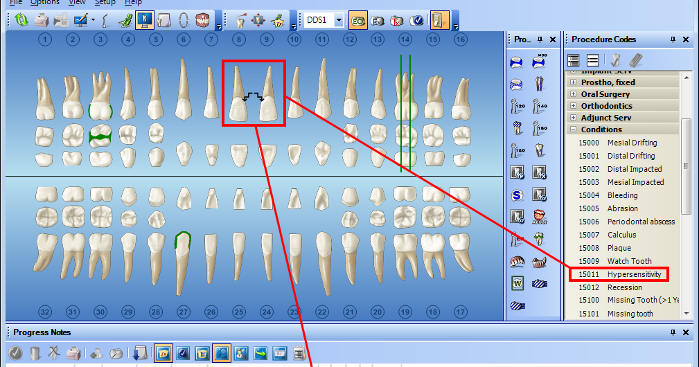 How To Chart Supernumerary Teeth In Dentrix