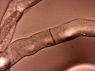 Neurospora crassa