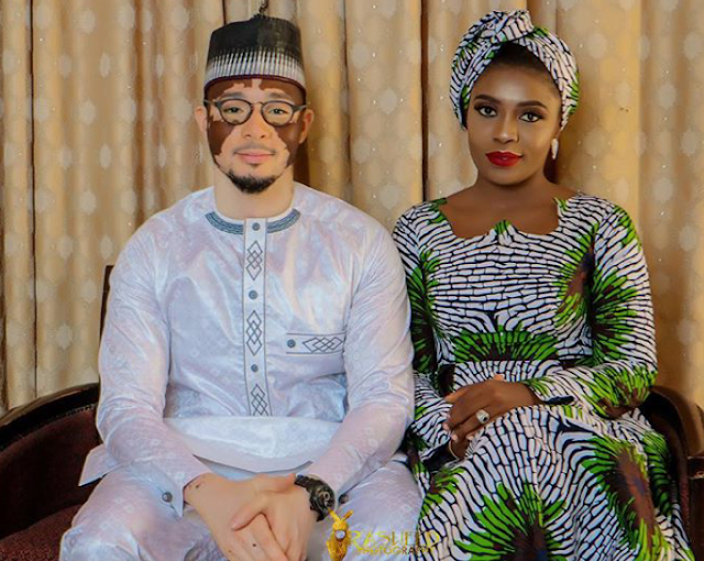 Beautiful photos from the wedding ceremony of Nigerian man who suffers from skin condition, vitiligo