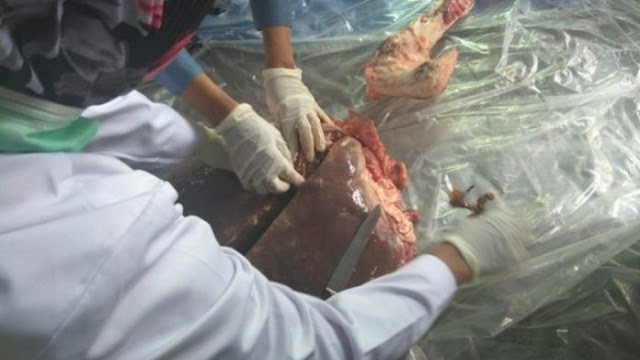 Ditemukan Cacing Hati di Sapi Kurban Pemberian Presiden Jokowi Ditemukan Cacing Hati di Sapi Kurban Pemberian Presiden Jokowi