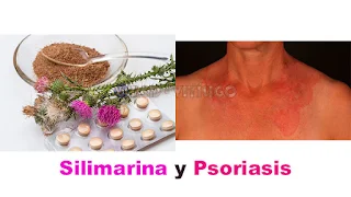 Silimarina y Psoriasis