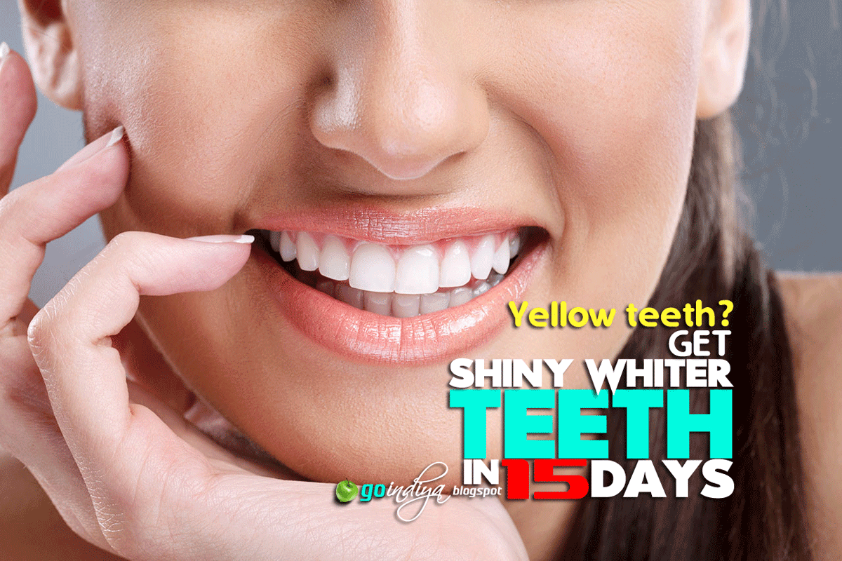 How to Whiten Extremely Yellow Teeth in 15 Days? 21 Teeth Whitening