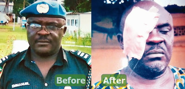 nigeria police asp blind emmanuel mbilla nigeria police asp blind emmanuel mbilla