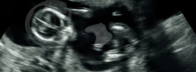 Ultrasound with gamer baby holding XBox 360 controller