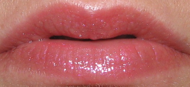lip conditions - Symptoms, Treatments and Resources for ...