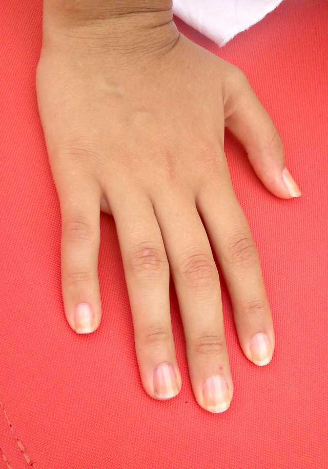 What Does It Mean When Your Nails Are Yellow Nails Magazine