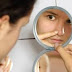 Clear Your Acne Up With Easy Steps