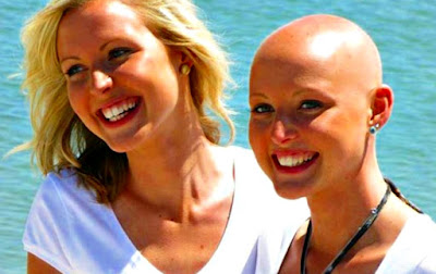 Mujeres cáncer pérdida de cabello tratamientos Cáncer mujeres pérdida cabello