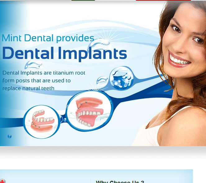 Mint Dental Alaska Dentist in Anchorage uses Ceramic Implants to Build