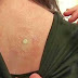THE DOCTOR TAPED A SMALL BATTERY ON HER BACK – WHAT HAPPENED NEXT – SHE WILL REMEMBER THIS FOR THE REST OF HER LIFE