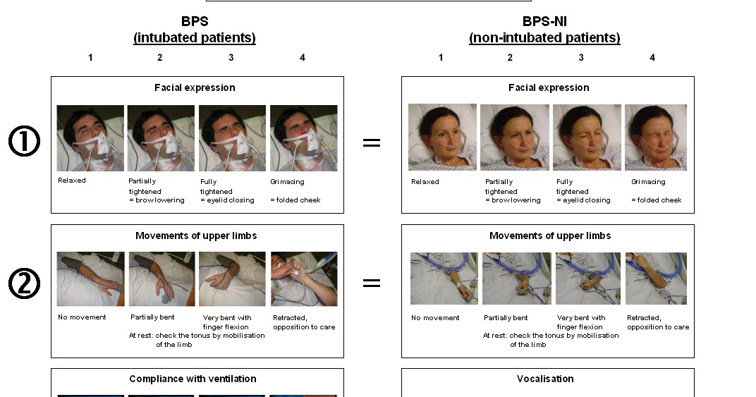 Sinaune Perawat Behavioral Pain Scale BPS sinaune-perawat-behavioral-pain-scale-bps