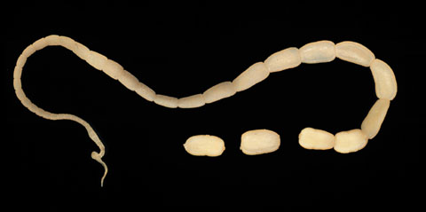 pinworm pszichoszomatika felnőttkorban helminták a szemgolyóban
