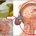 Make Migraine Disappears In Just 10 Minutes With This Powerful Natural Drink