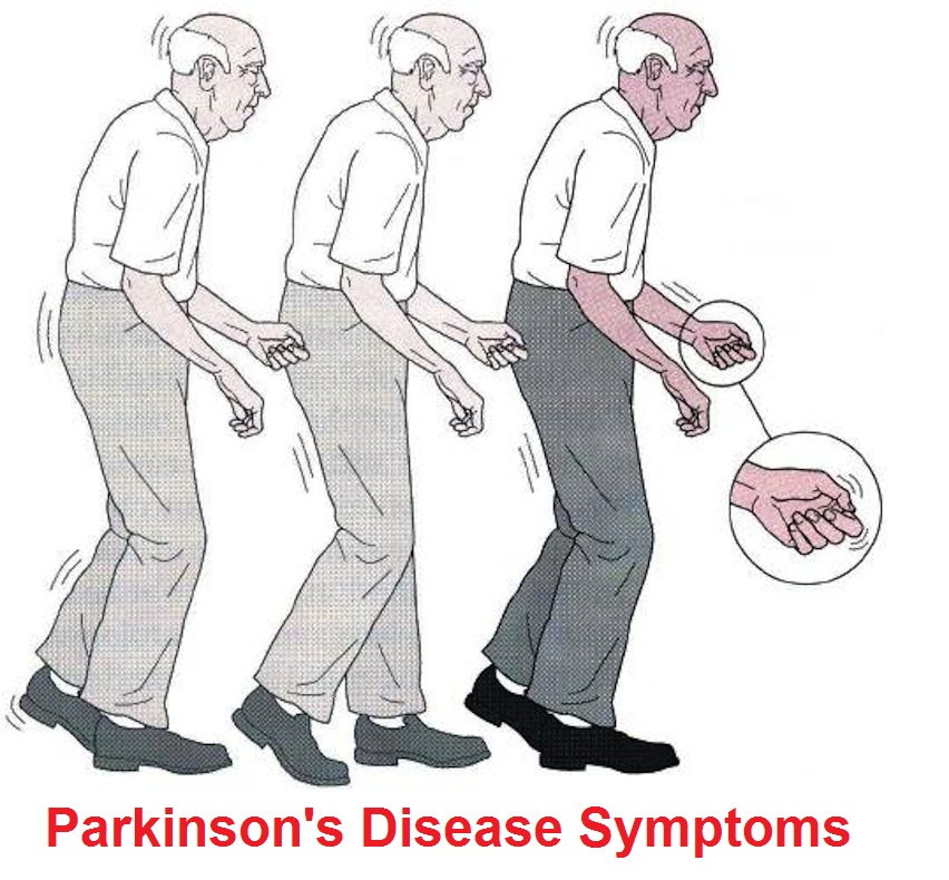 Болезнь паркинсона ног