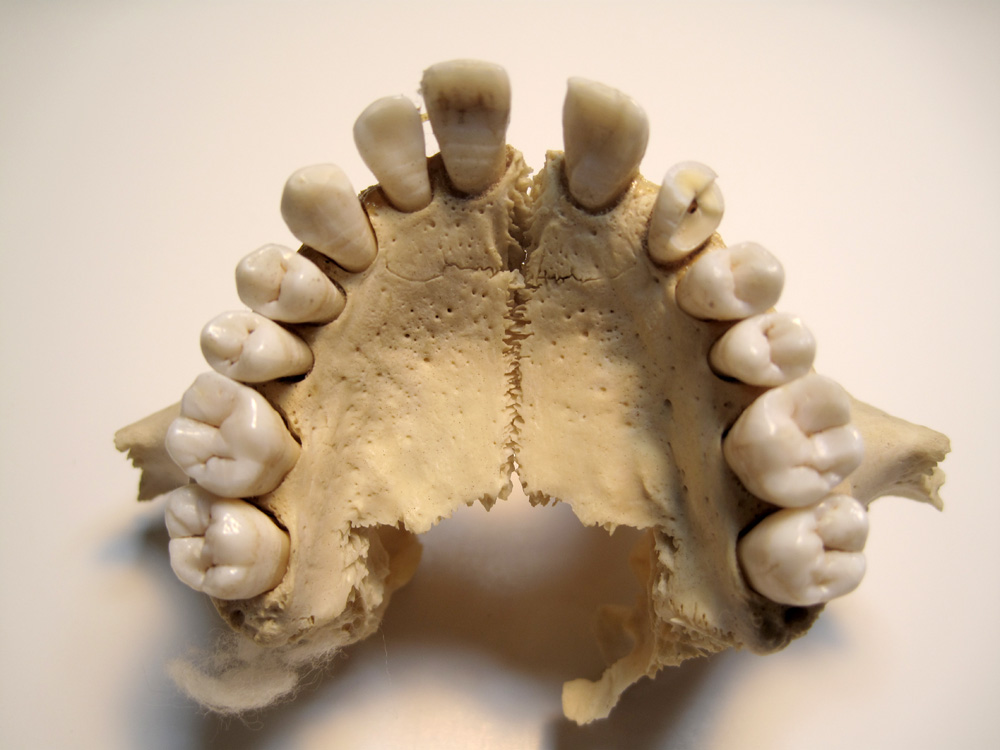 The Expressive Figure The Disarticulated Skull