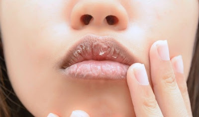 Why Are Your Lips So Dry, And How To Make Your Lips Soft