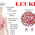 What's Characteristics Of Various Types Of Leukemia?