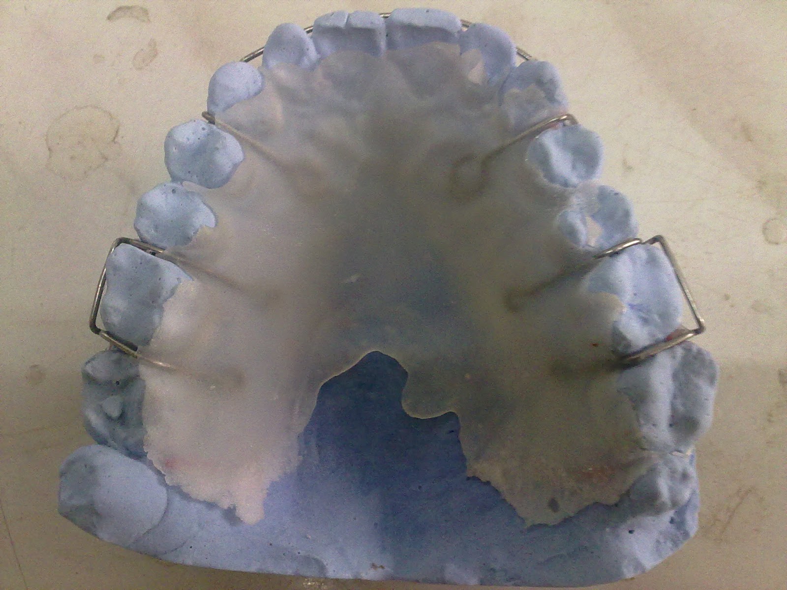 جهاز التثبيت (retainer) Smile maker