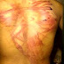 BRUTAL: Avó é presa após "tirar" sangue do neto a golpes de cinto