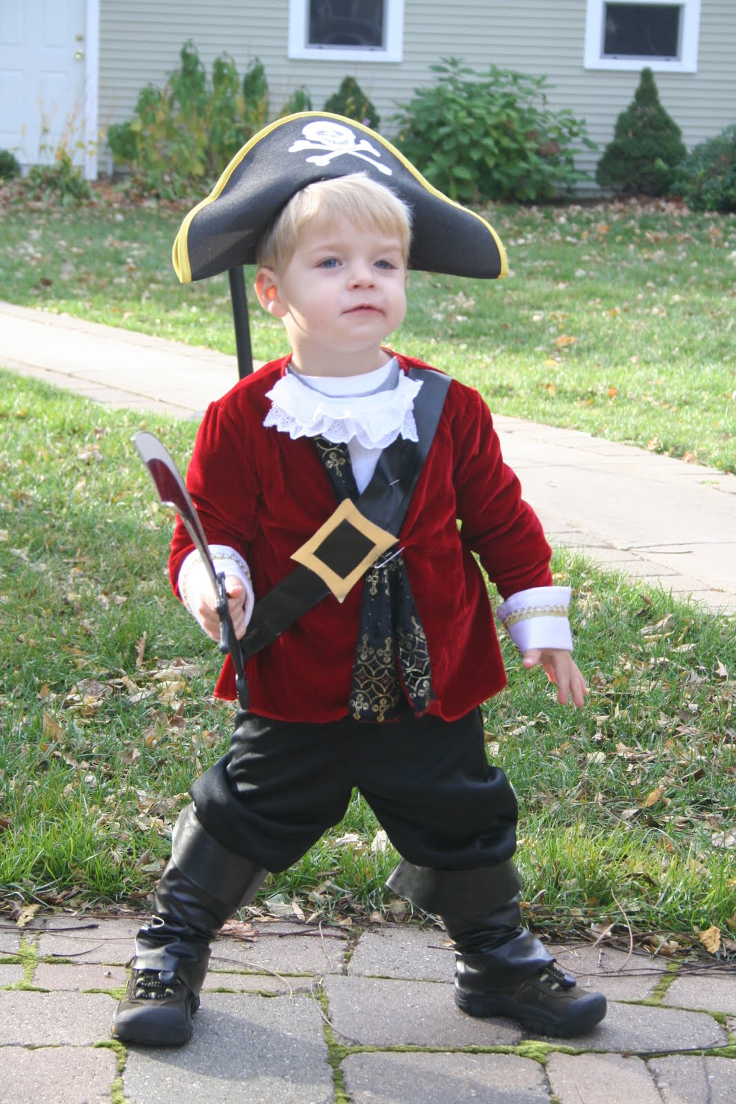 Congenital Ptosis Photos 12+ months after frontalis sling surgery