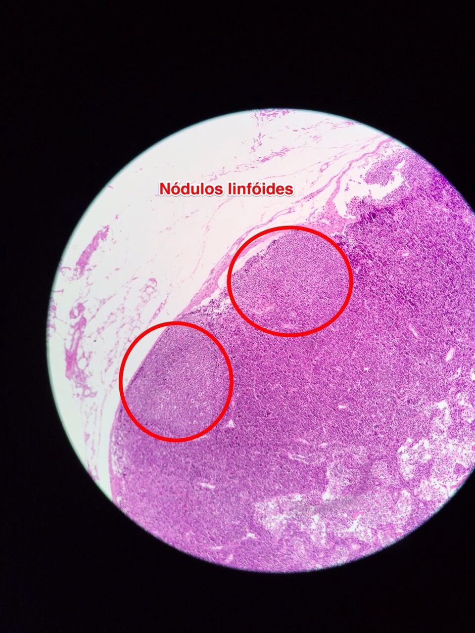 HISTOLOGIA90: HISTOLOGIA DO SISTEMA LINFOIDE - INFLAMAÇÃO CRÔNICA