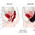 You Are Not Fat! Your Stomach Is Bloated And Here Is How To Get Rid Of It!