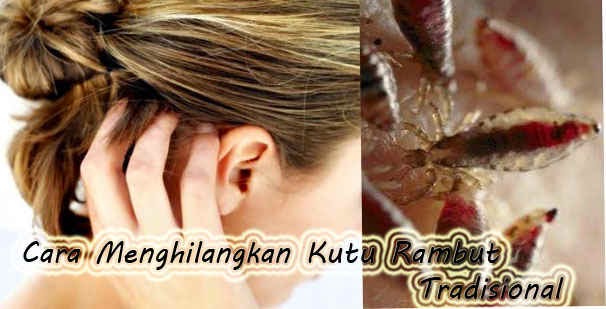 Cara Menghilangkan Kutu Rambu