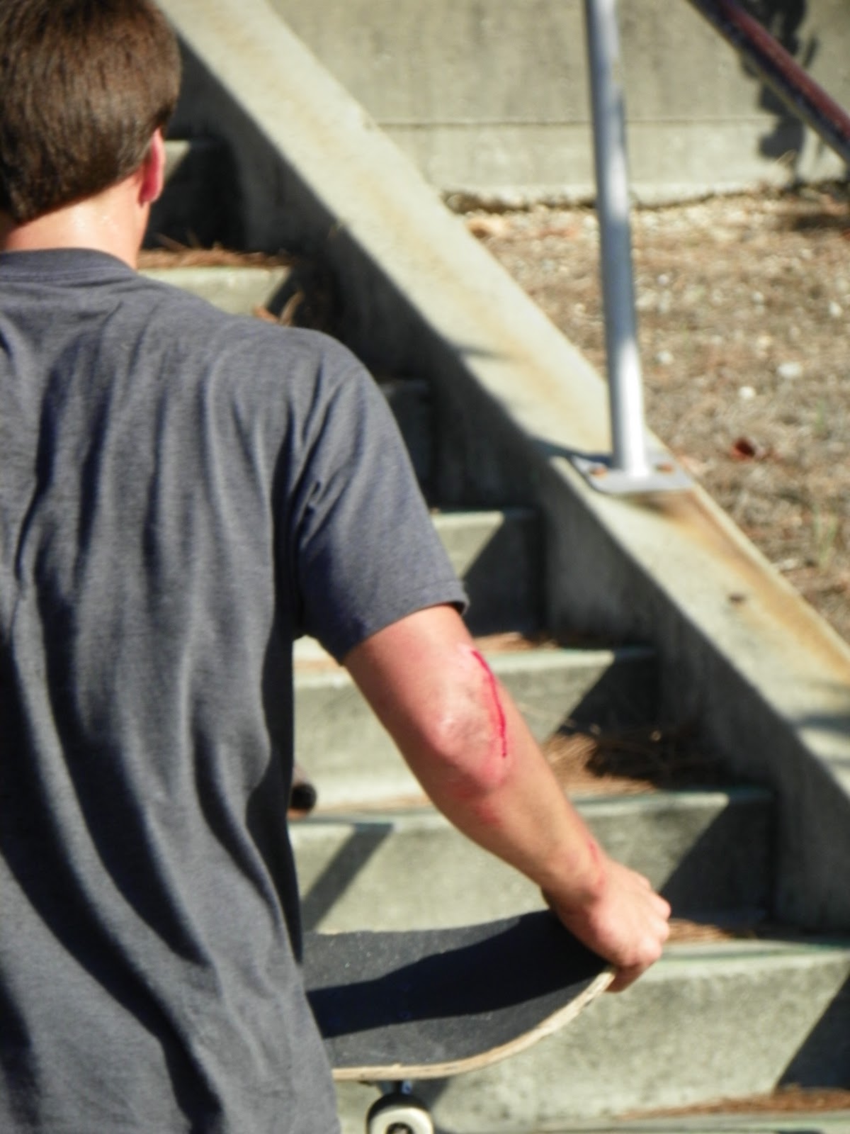 unearthed skateboarding Bloody Elbow