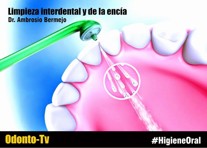 HIGIENE ORAL: Limpieza interdental y de la encía - Entrevista al Dr. Ambrosio Bermejo