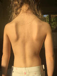 Prominent shoulder blades with broad shoulders and narrow waist back view of prominent shoulder blades