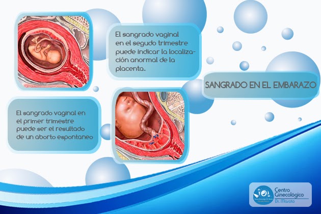 Sangrado Durante El Embarazo Causas Y Pasos A Seguir | Hot Sex Picture