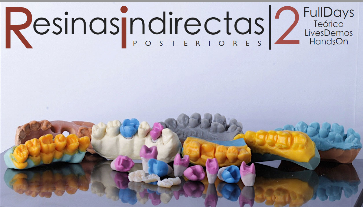 Clínica Dental y Capacitación RESINAS INDIRECTAS POSTERIORES Pablito