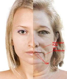 exercises facelift sagging nasal