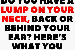 DO YOU HAVE A LUMP ON YOUR NECK, BACK OR BEHIND YOUR EAR? HERE�S WHAT YOU NEED TO KNOW